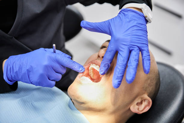 Best Emergency Root Canal Treatment in Edmonds, WA